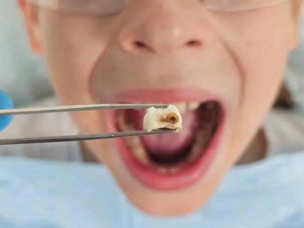 Best Urgent Dental Care for Toothache in Georgetown, DE