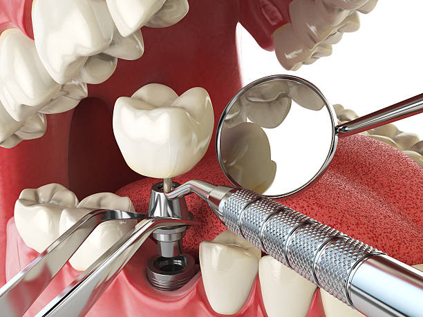 Professional Emergency Dentist in DE